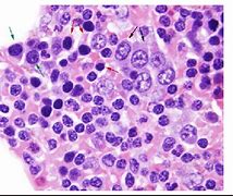 Hematoxylin Stain